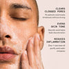 DAILY ACNE CLEANSER
