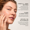 ACNE ESSENTIALS DUO