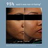 ACNE PRECISION SERUM