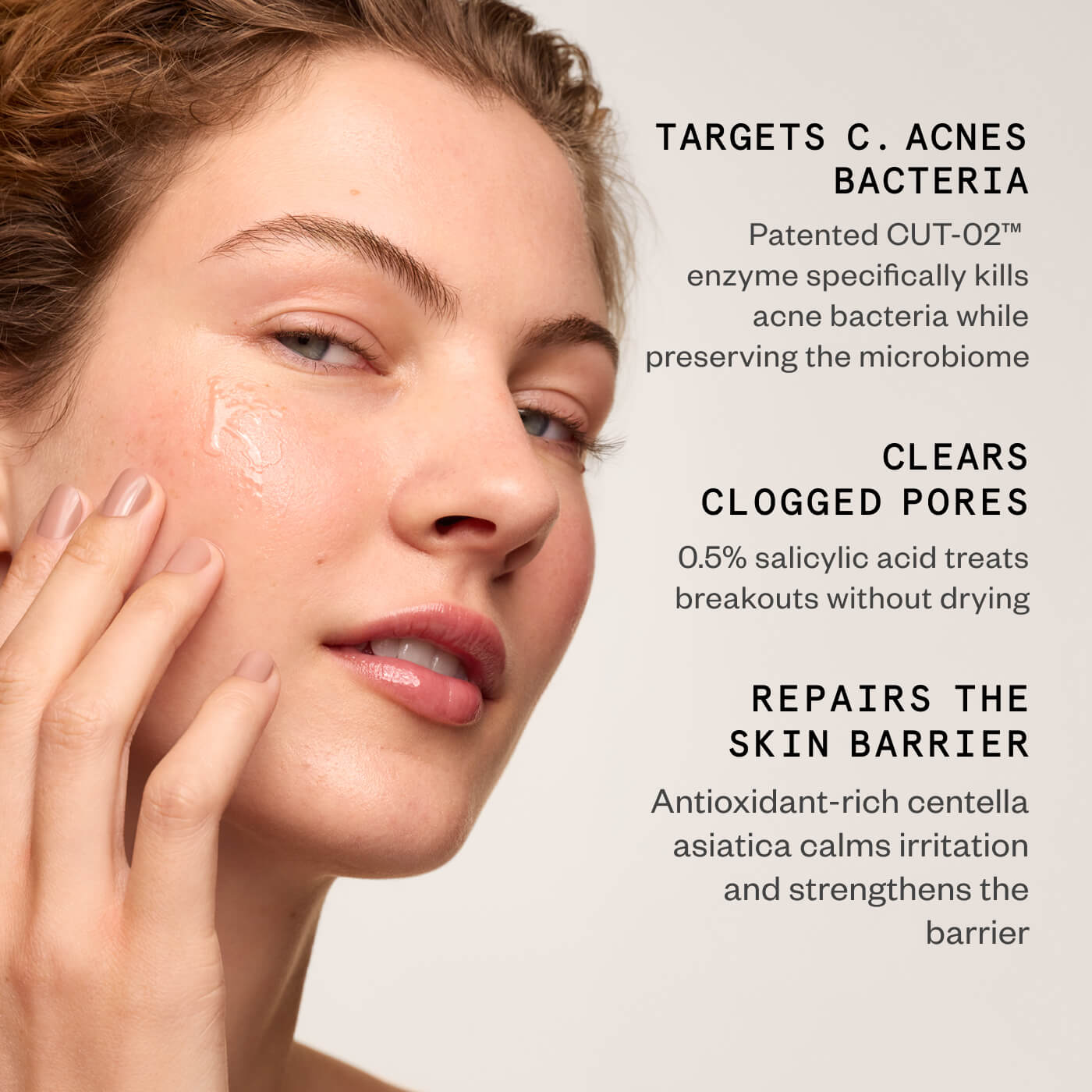 ACNE PRECISION SERUM