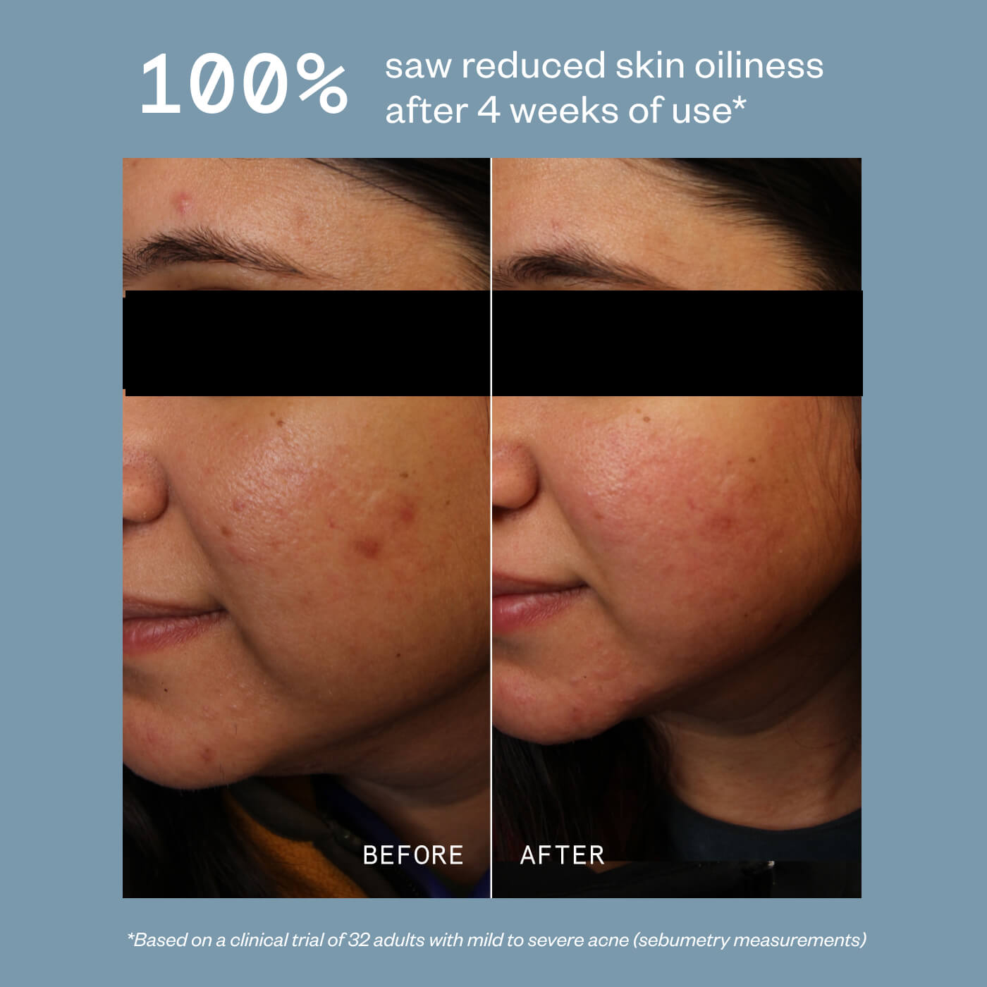 DAILY ACNE CLEANSER