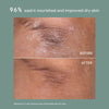 ECZEMA PRECISION KIT
