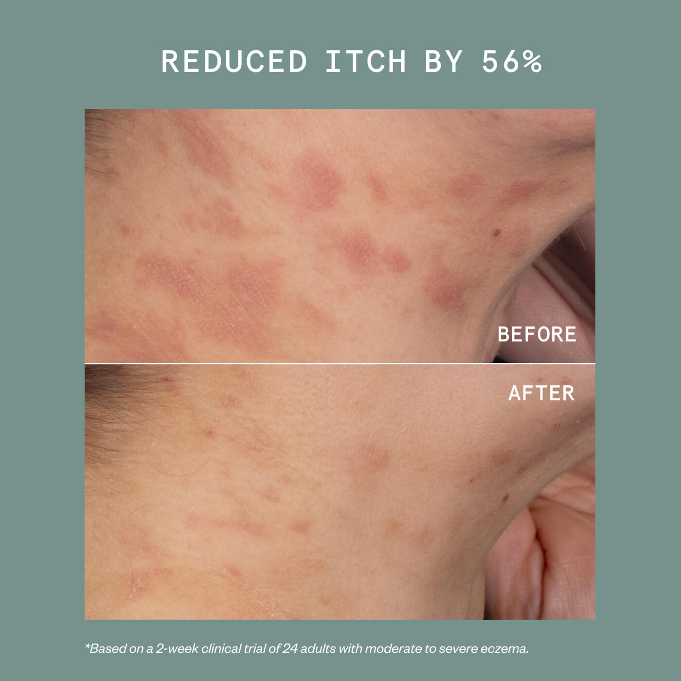 Eczema Relief + Repair Duo