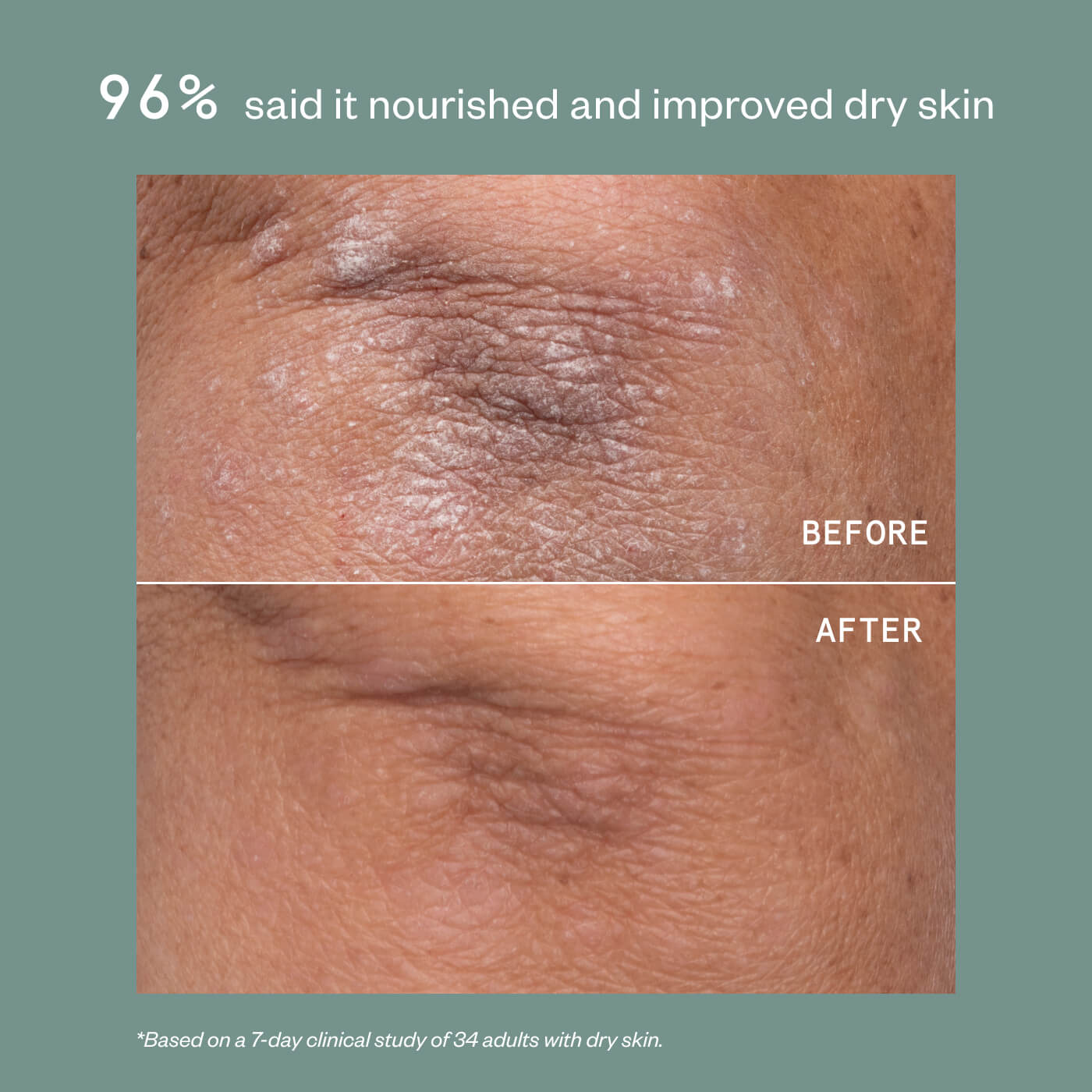 Eczema Relief + Repair Duo
