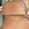 Soothe + Repair Duo