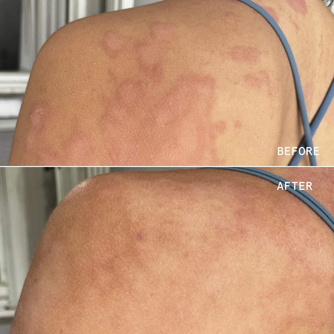 Soothe + Repair Duo