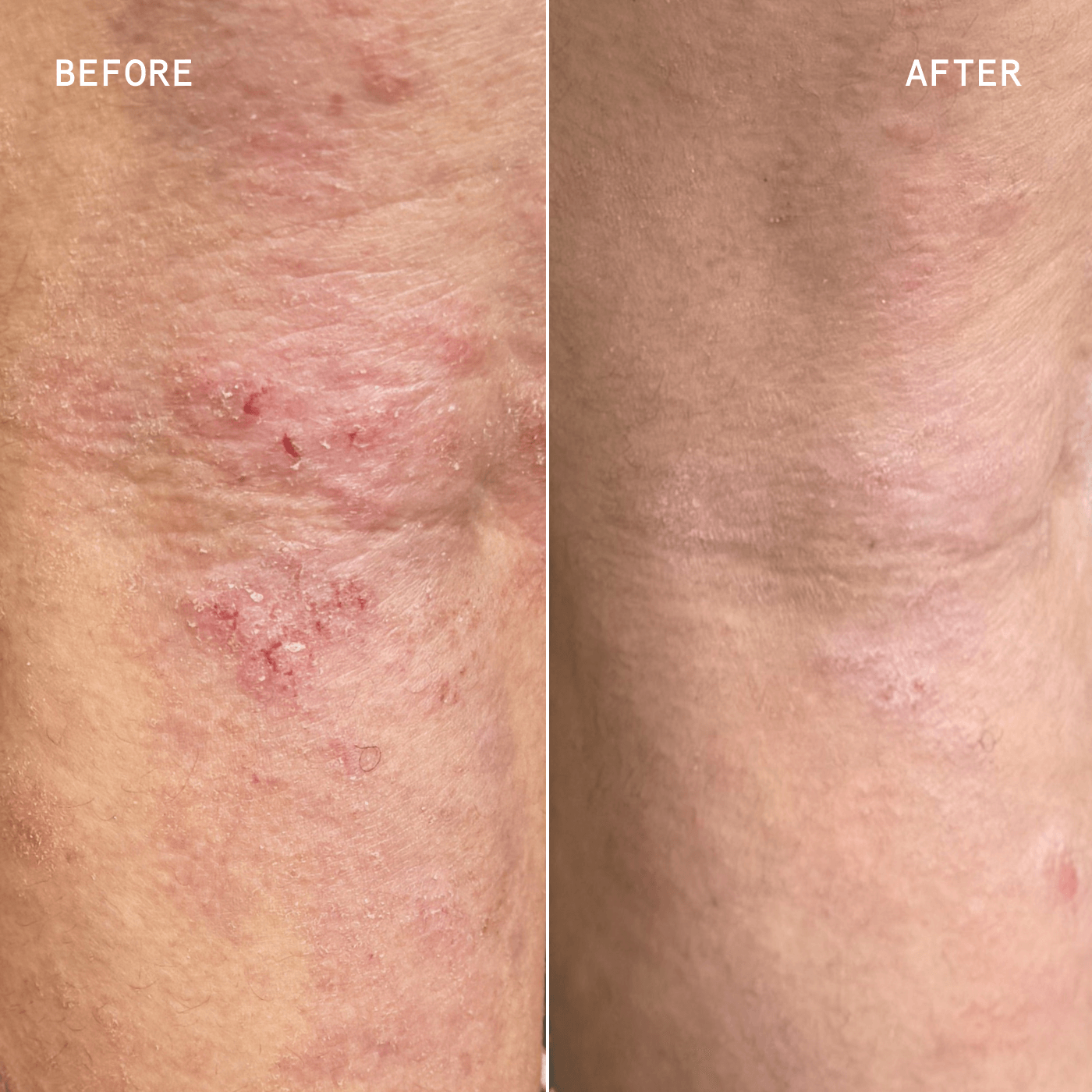 Soothe + Repair Duo