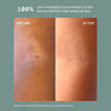 ECZEMA THERAPY CREAM
